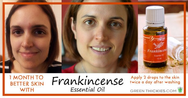 1 month to better skin with Frankincense essential oil